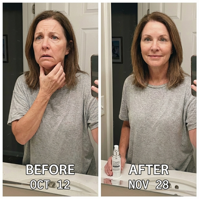 Review image from Linda M., 58