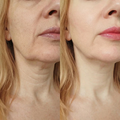 Review image from Diane K., 54