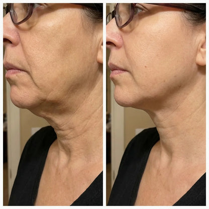 Snap-Back Serum