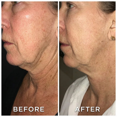 Review image from Patricia R., 62