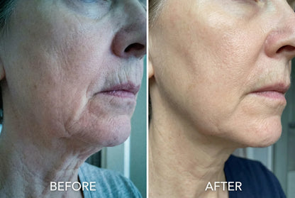 Snap-Back Serum