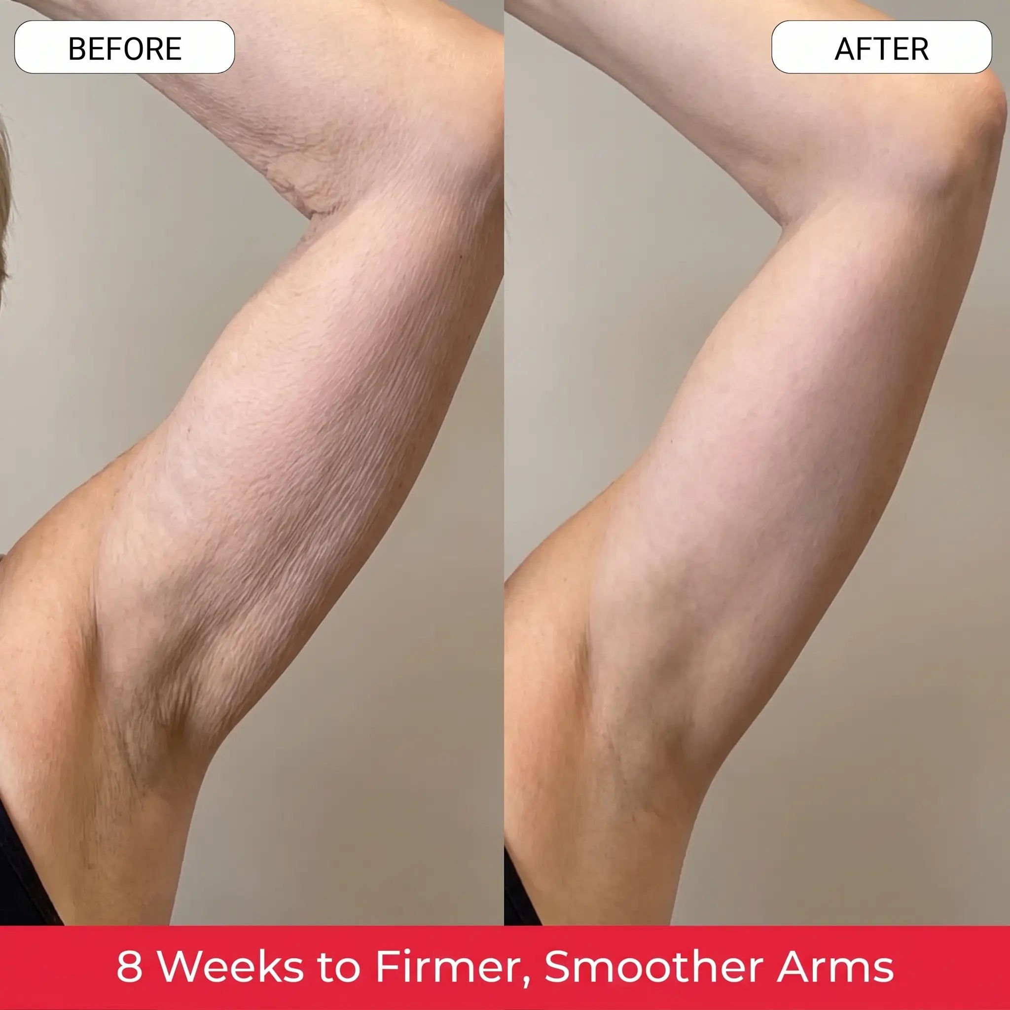 Before and after, same lighting, same angle, arm raised the same way. 8 weeks, nightly use.