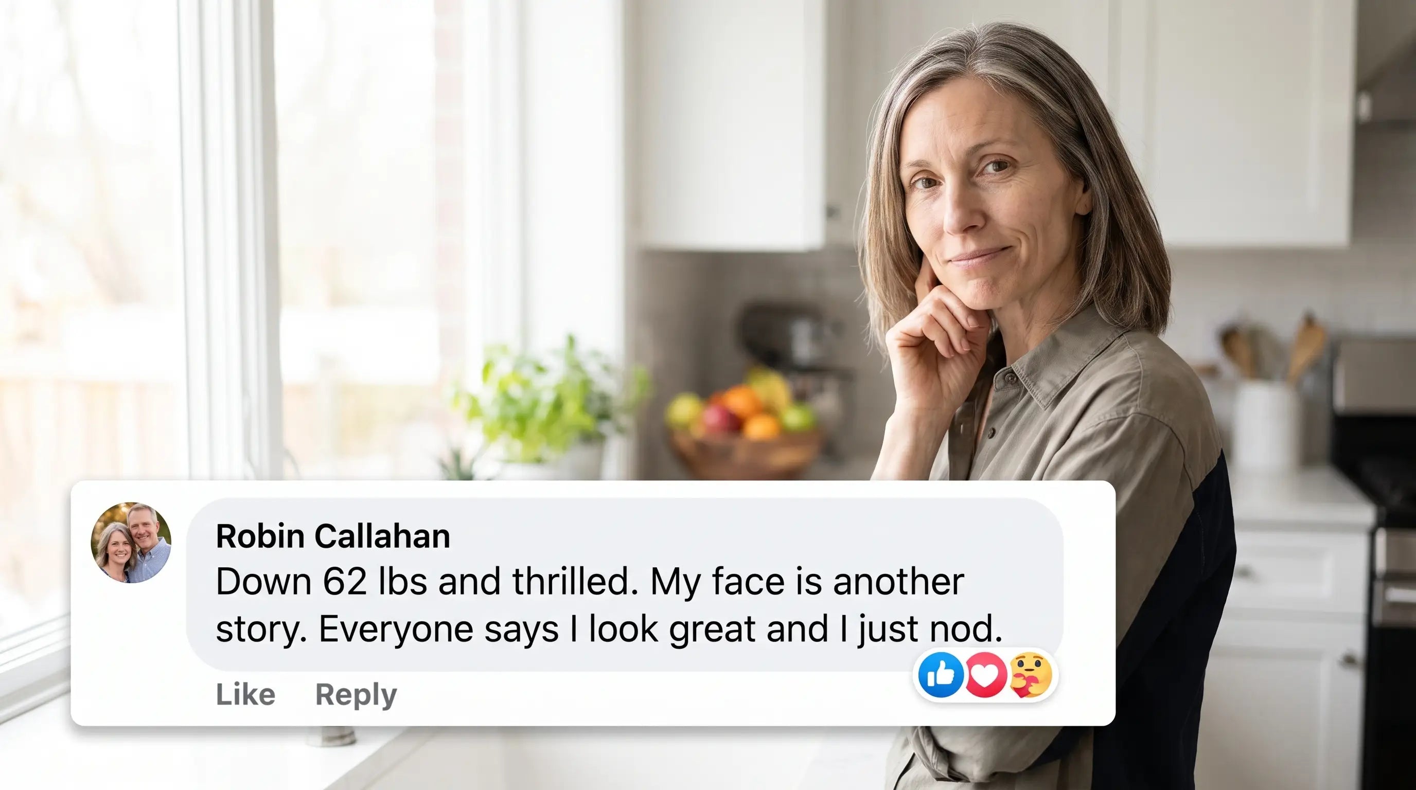 Robin Callahan: down 62 lbs and thrilled, my face is another story